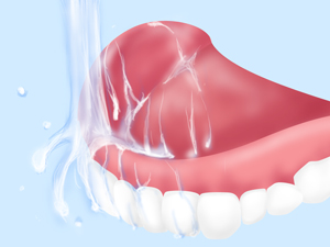 正しい入れ歯のお手入れとは